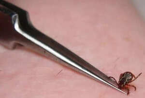 Обережно – кліщі! детская больница запорожье КНП «Міська дитяча лікарня №5» ЗМР – це єдина у місті Запоріжжі багатопрофільна дитяча лікарня, де сконцентровано всі види надання спеціалізованої медичної допомоги дитячому населенню: стаціонарної, консультативної амбулаторно-поліклінічної та виїзної для інтенсивної терапії новонародженим.