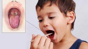 Дифтерія повертається?! детская больница запорожье КНП «Міська дитяча лікарня №5» ЗМР – це єдина у місті Запоріжжі багатопрофільна дитяча лікарня, де сконцентровано всі види надання спеціалізованої медичної допомоги дитячому населенню: стаціонарної, консультативної амбулаторно-поліклінічної та виїзної для інтенсивної терапії новонародженим.